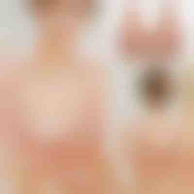 Čipkasti Grudnjak s Prednjim Zatvaranjem | FRONTBRA